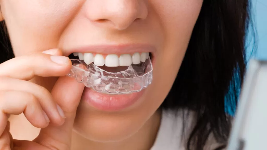 ALINEADORES EN CUENCA